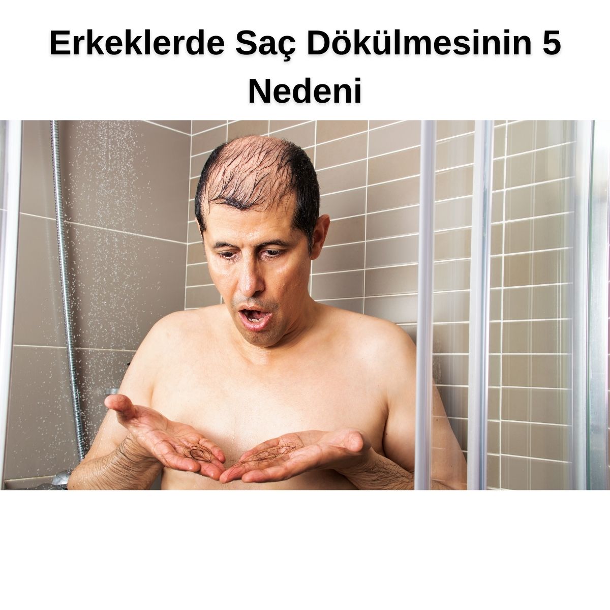 Erkeklerde Saç Dökülmesi: Nedenleri ve Çözüm Önerileri
