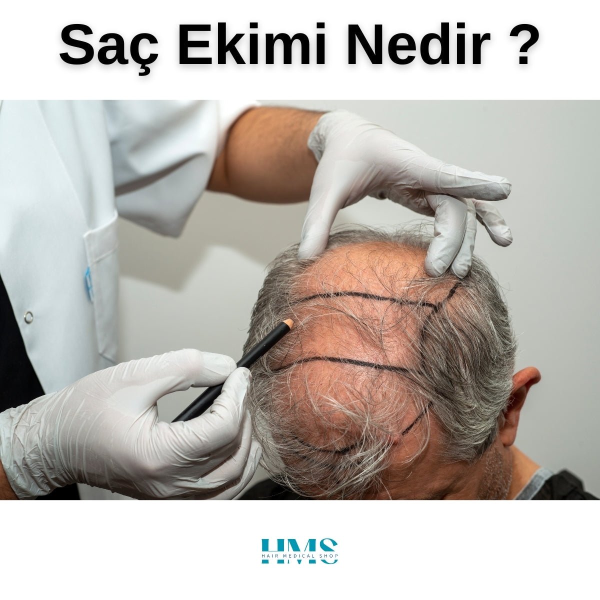 Saç Ekimi Nedir? - HAİR MEDİCAL SHOP