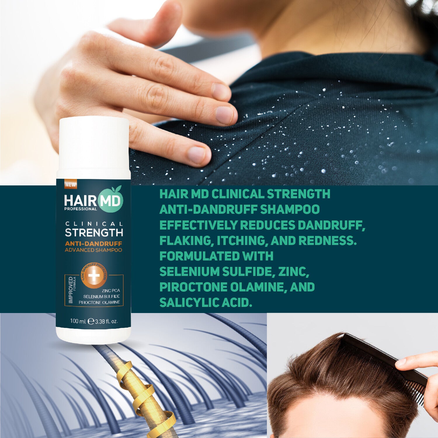 HairMD Clinical Strength Anti-Dandruff Shampoo (100ml Travel Size)