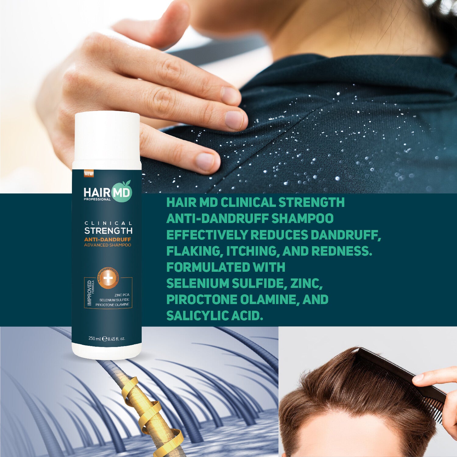 HairMD Clinical Strength Anti-Dandruff Advanced Shampoo (250ml)