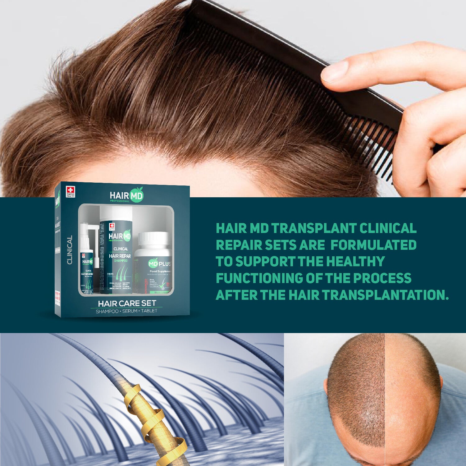 HairMD Clinical Hair Repair Set (1-Month Starter Kit)