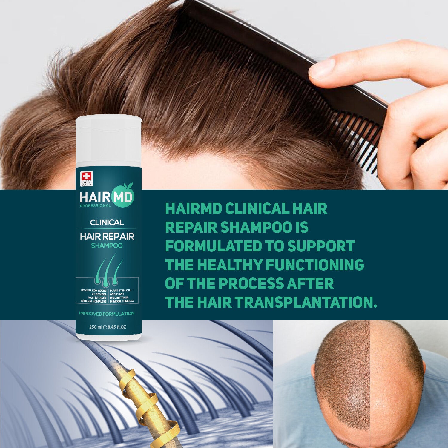 HairMD Clinical Hair Repair Shampoo (250ml)