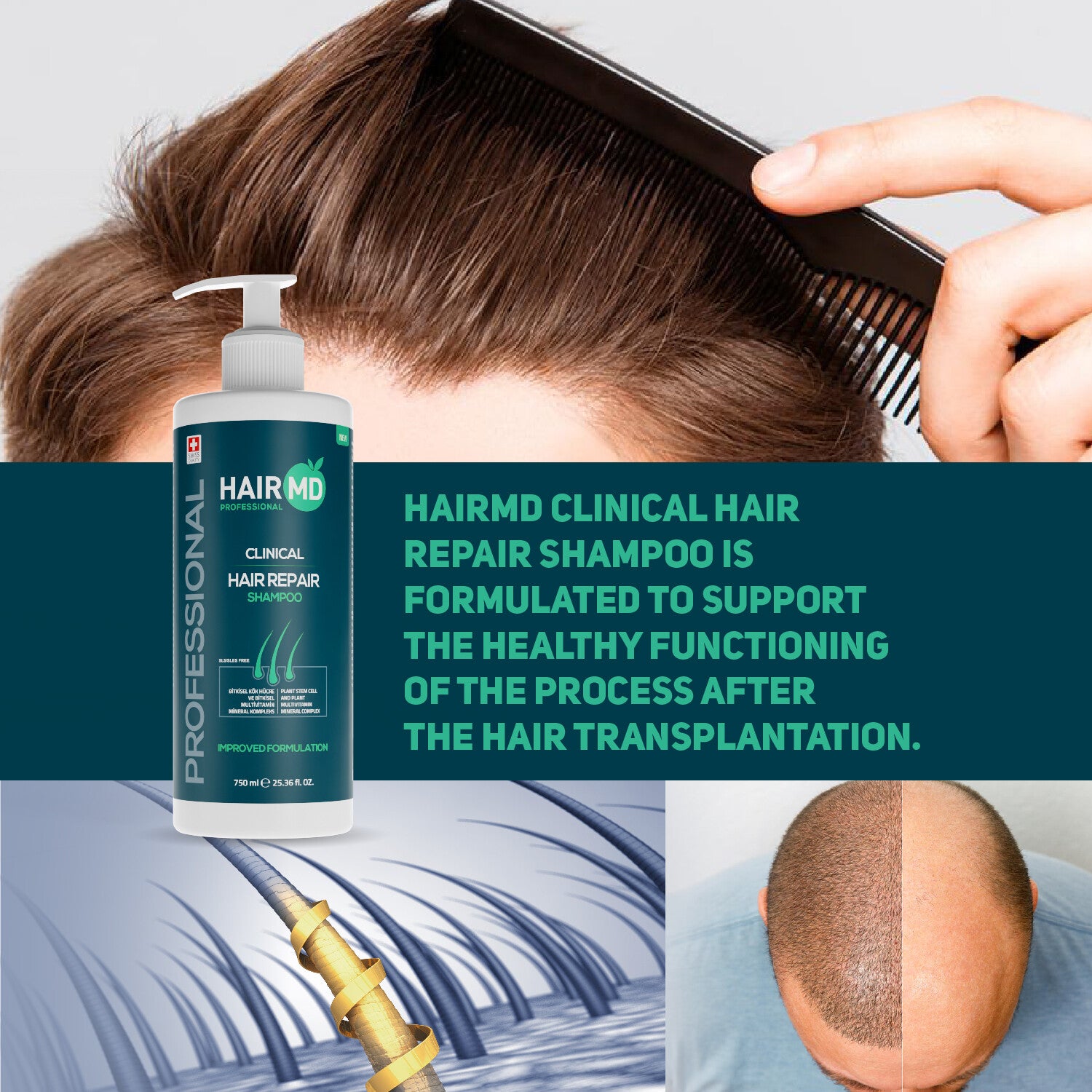 HairMD Clinical Hair Repair Shampoo 750ml (Professional Size)