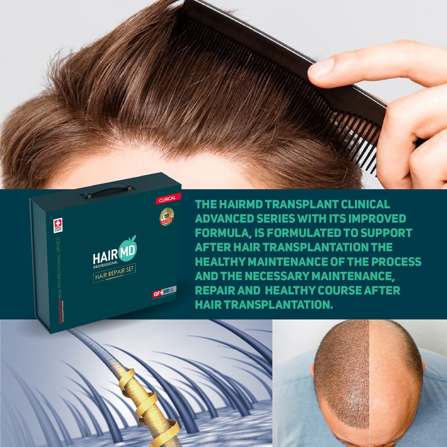 HairMD Clinical Hair Repair Exclusive Set (3-Month Intensive Kit)