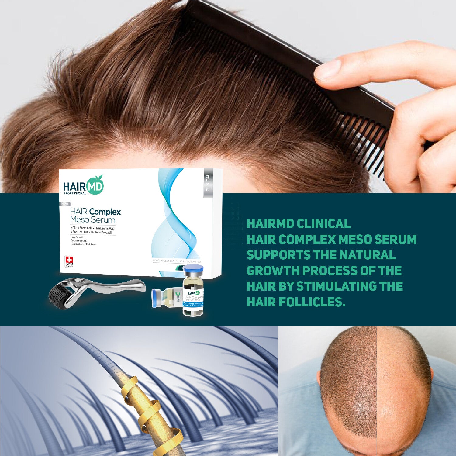 HairMD Clinical Hair Complex Meso Serum + Dermaroller Set