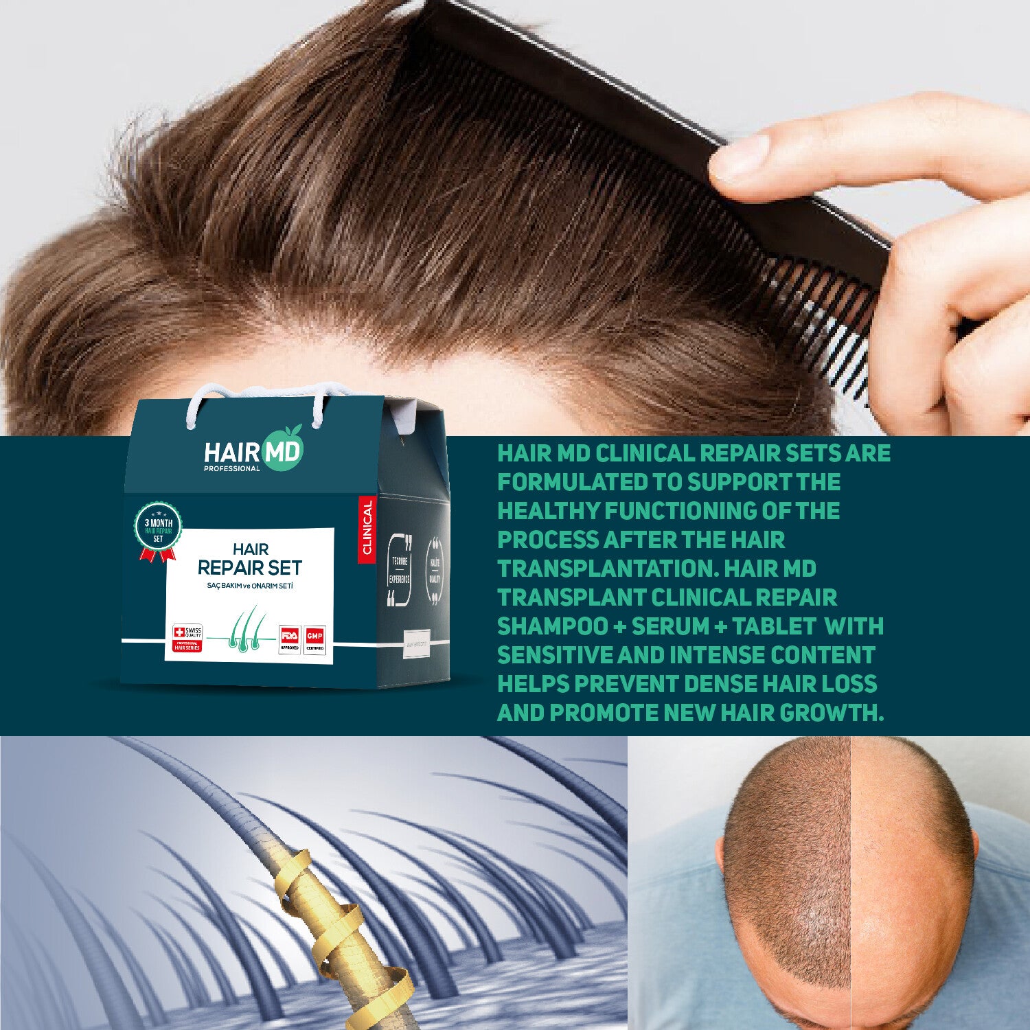 HairMD Clinical Hair Repair Set (3-Month Essential Kit)