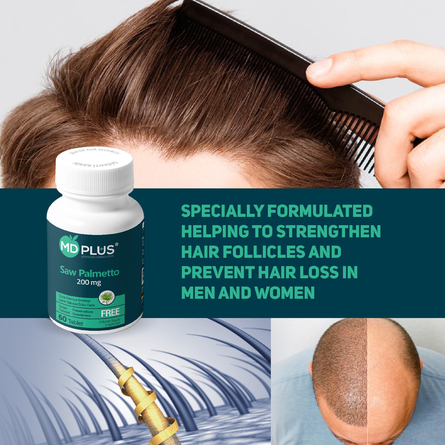 MD Plus Advanced Hair Saw Palmetto 200mg (60 Tablets)